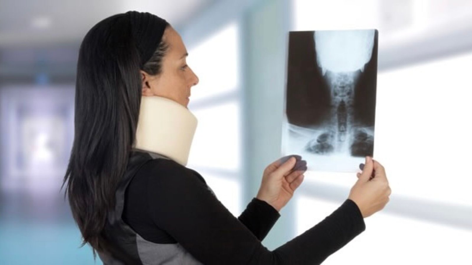 Colpo di frusta: la radiografia non è esclusivo mezzo di prova